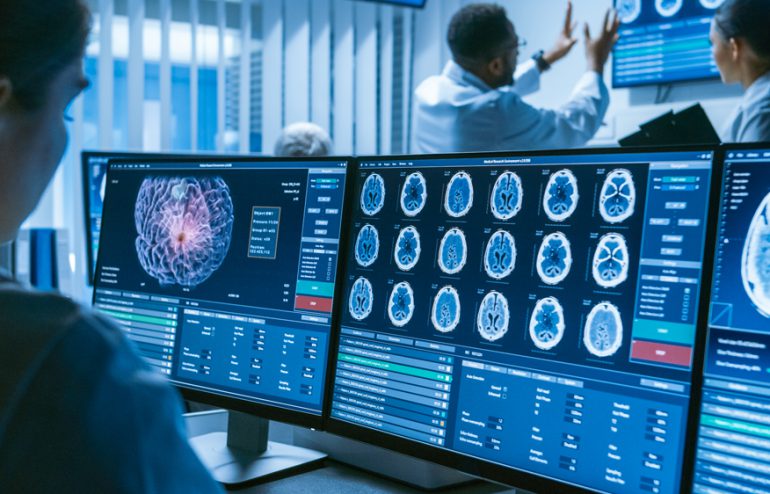 Radiologi berbasis film dan sistem PACS (filmless)